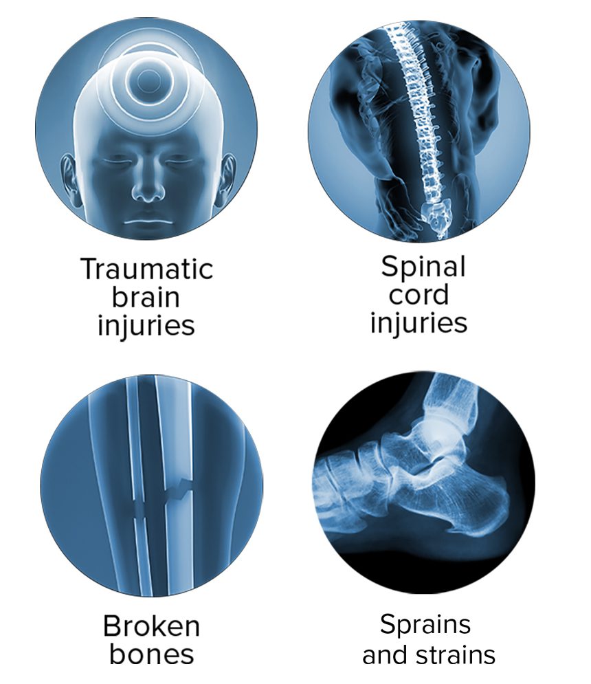 Common injuries from slip and fall
