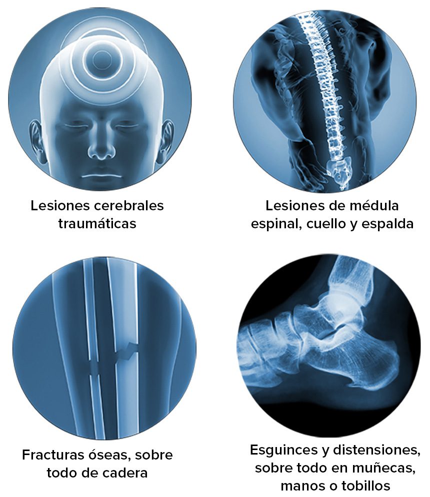 Resbalon y caidas