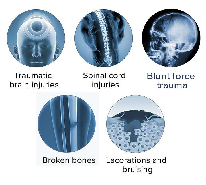 Common ATV injuries