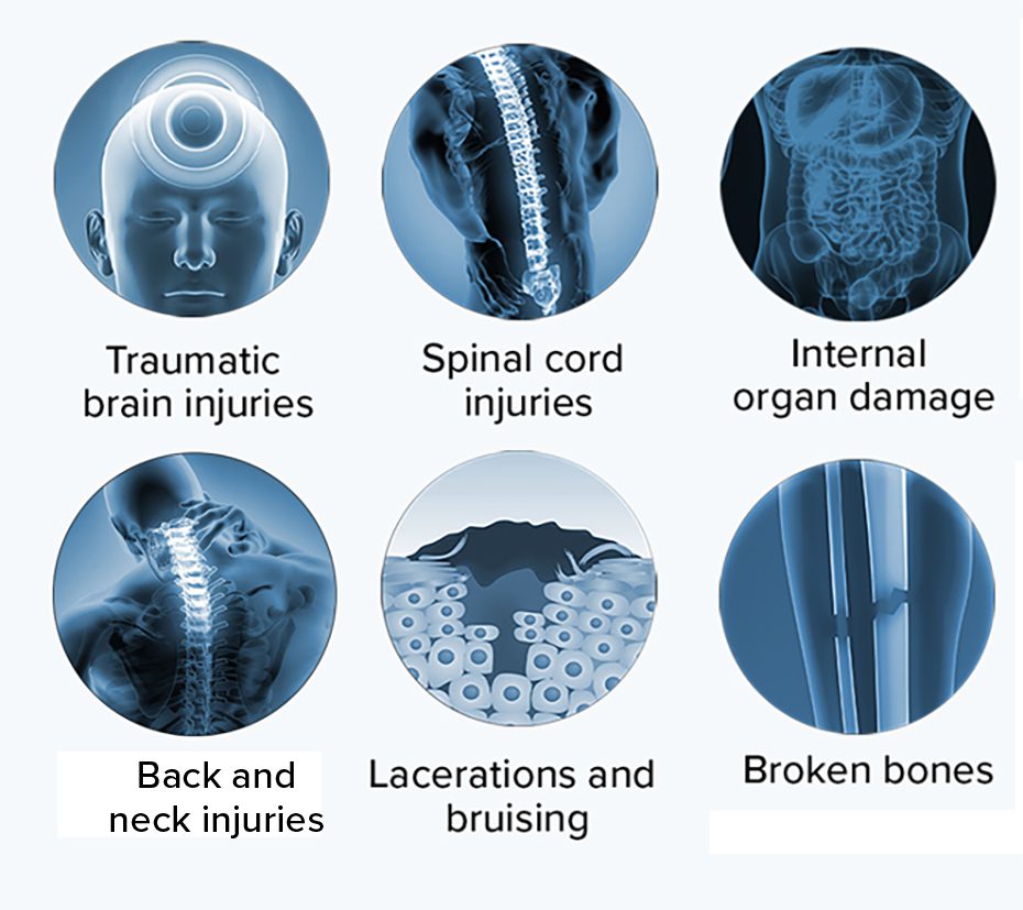 Common ATV Accident Injuries