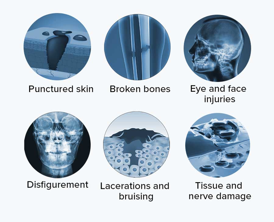 Common injuries from dog bites