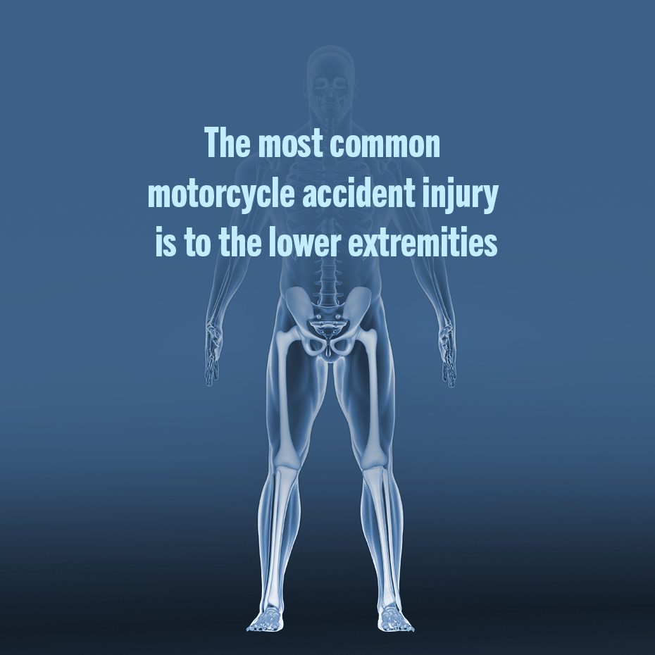 The most common motorcycle injures occur in the lower body