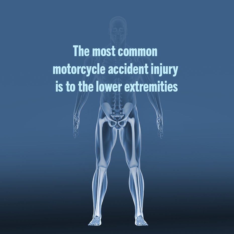 The most common injuries are to 