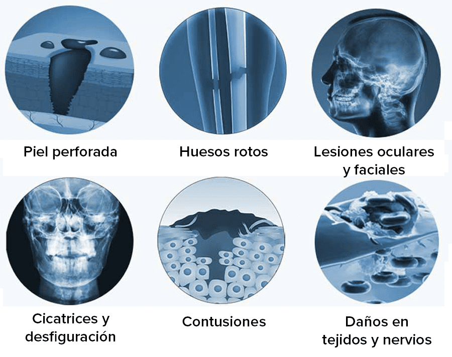 Lesiones por mordeduras