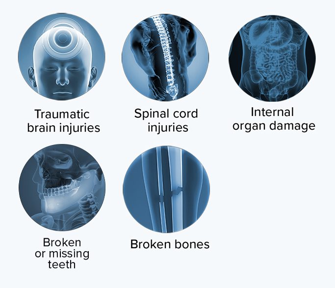 Common Injuries in pedestrian accidents