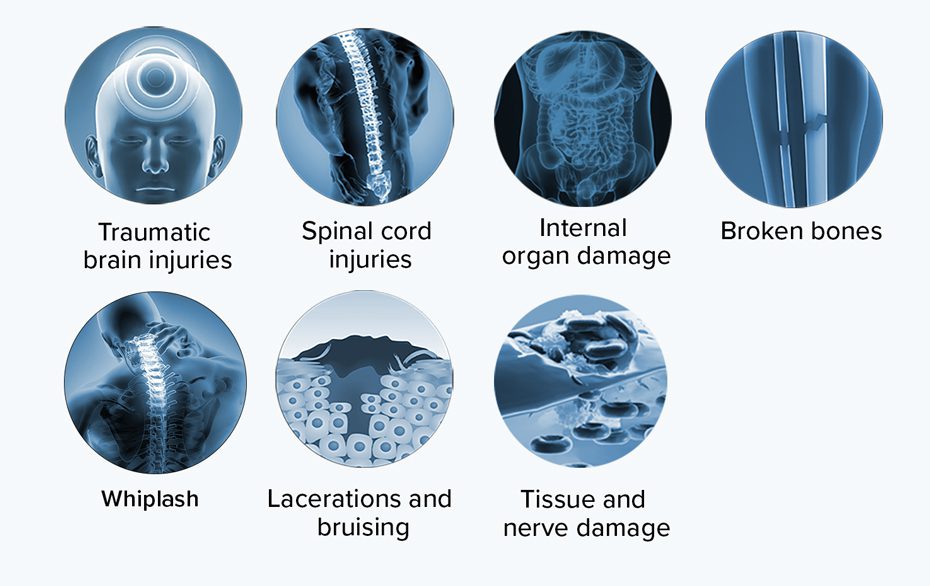Common injuries that occur from car accidents