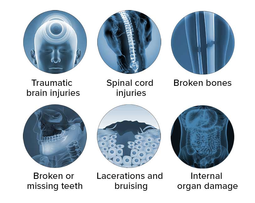 Common injuries in pedestrian accidents