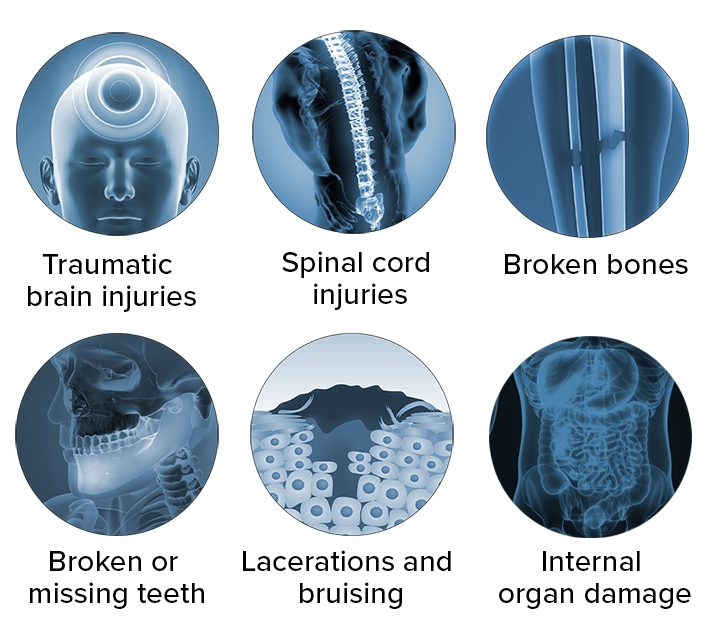 Common injuries in pedestrian accidents