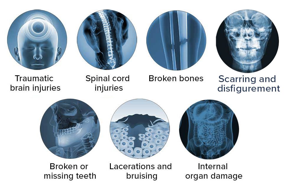 Common injuries that occur during pedestrian accidents