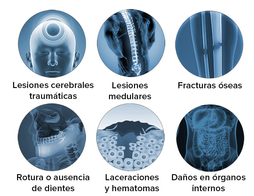 Lesiones pedestrian