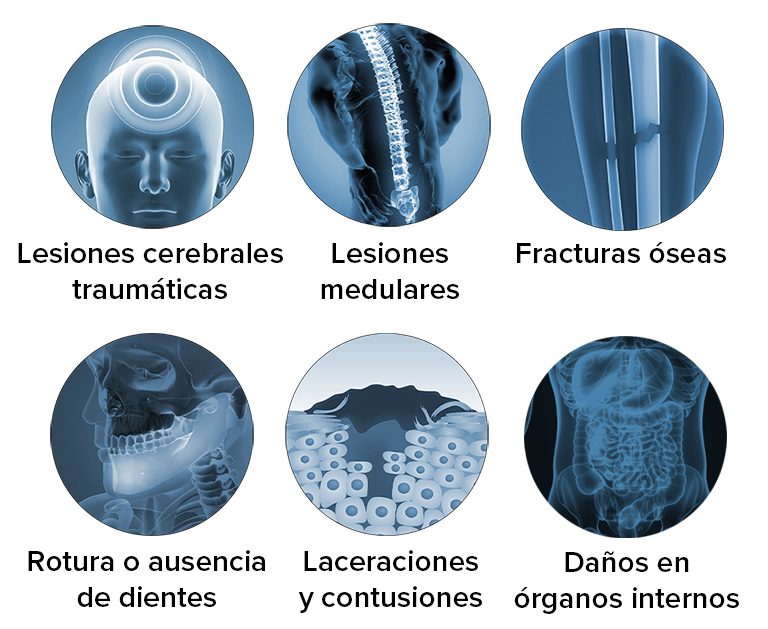 Lesiones de peatones