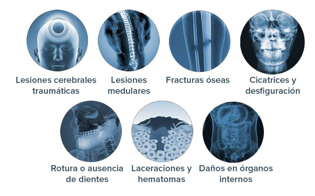 Lesiones