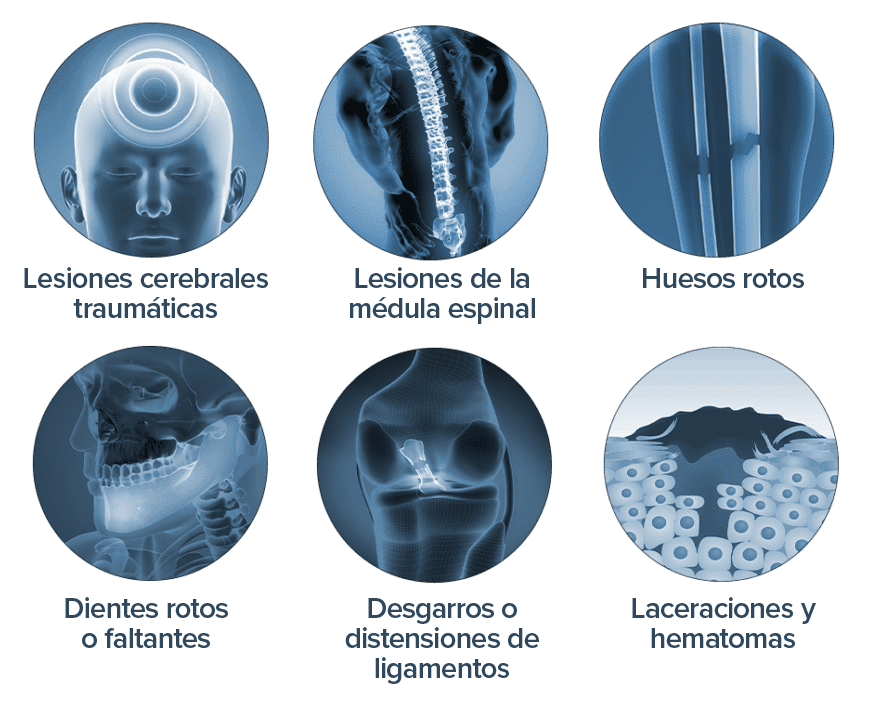 Lesiones bicicleta