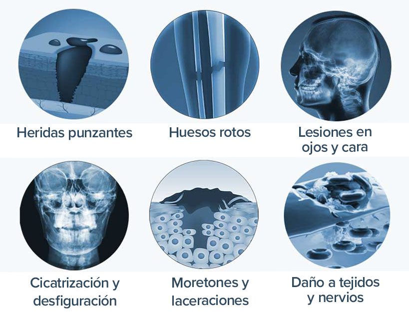 Common Injuries