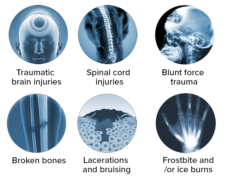 Common injuries from snowmobile accident