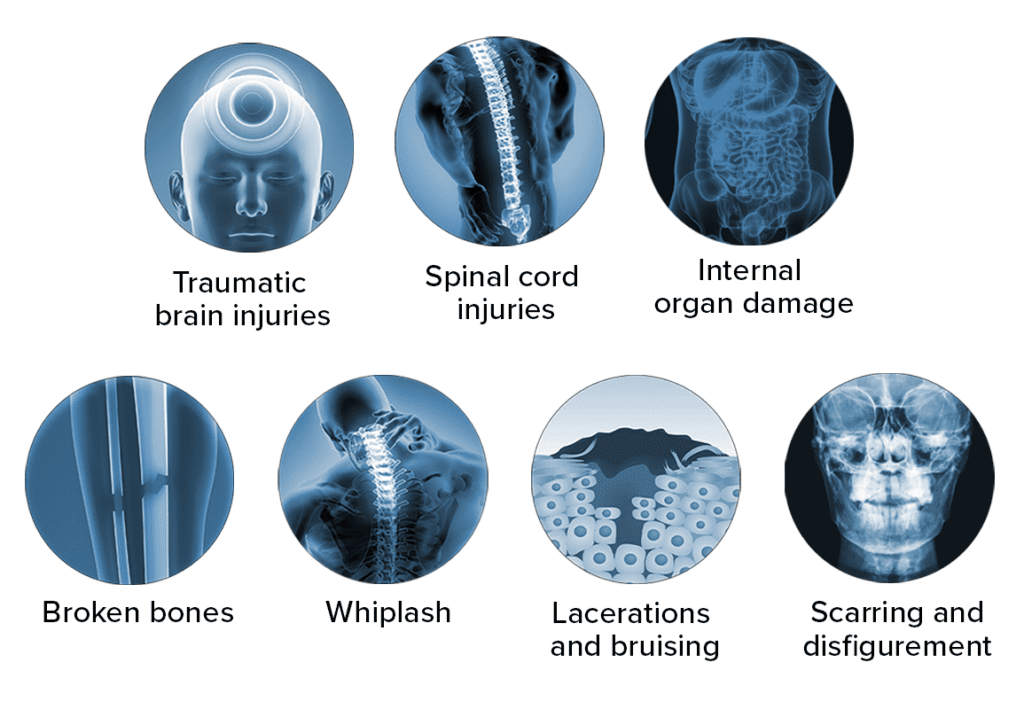 Common Injuries in Car Accidents