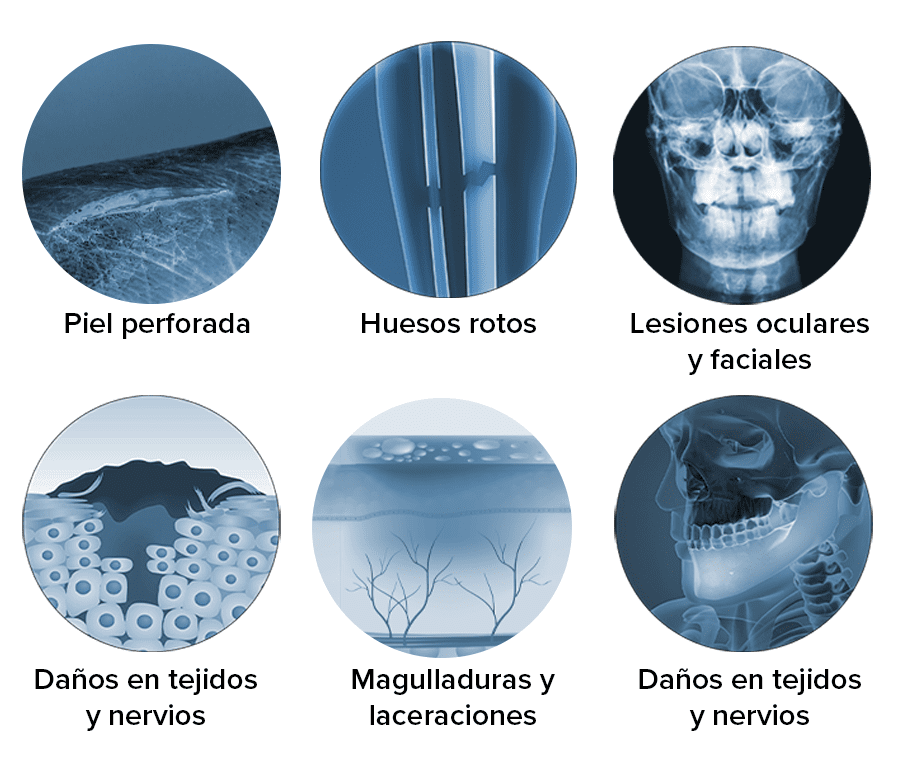 Lesiones por mordeduras