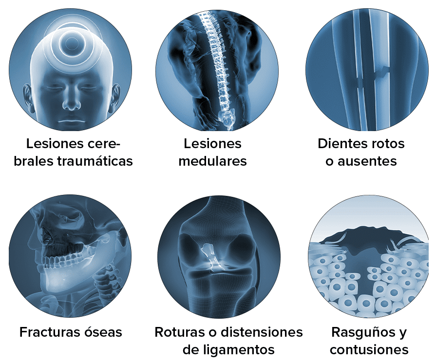 Common injuries