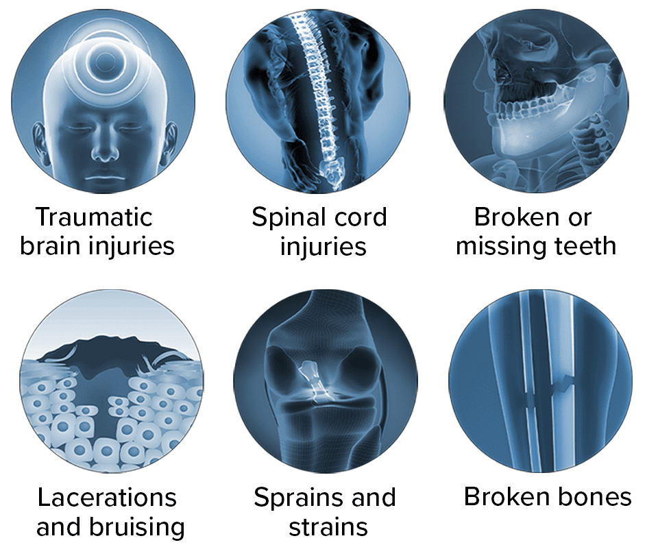 Common injuries with scooter injuries