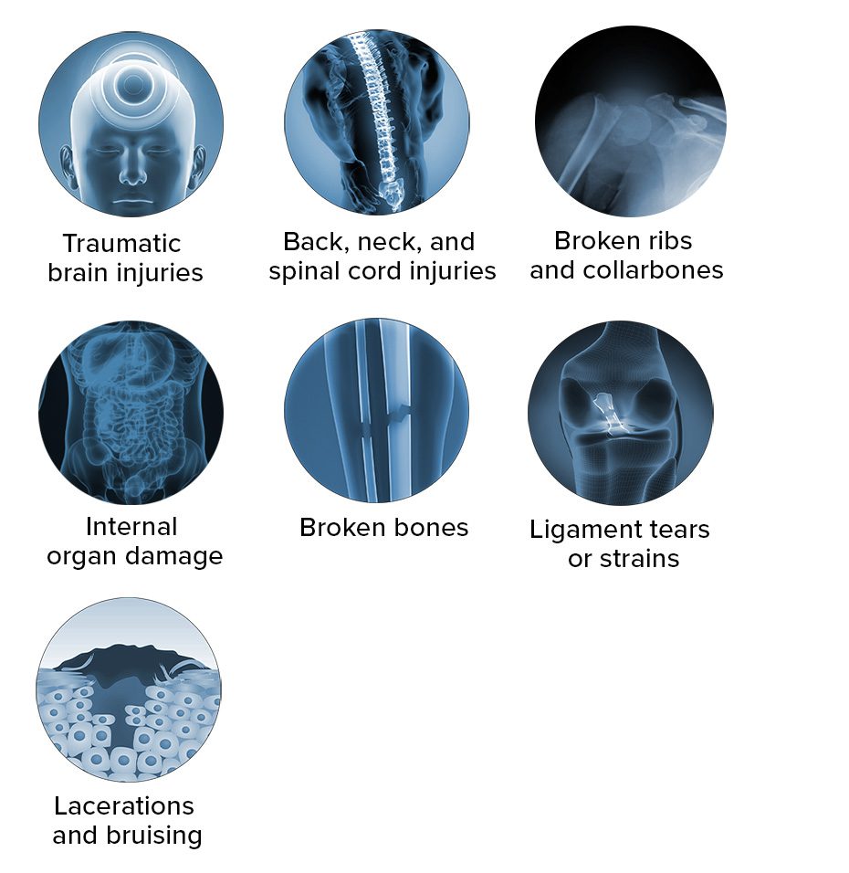 Graphic depicting common injuries from ATV accidents 