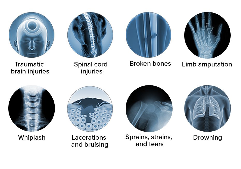 Graphic depicted common injuries than occur in boating accidents