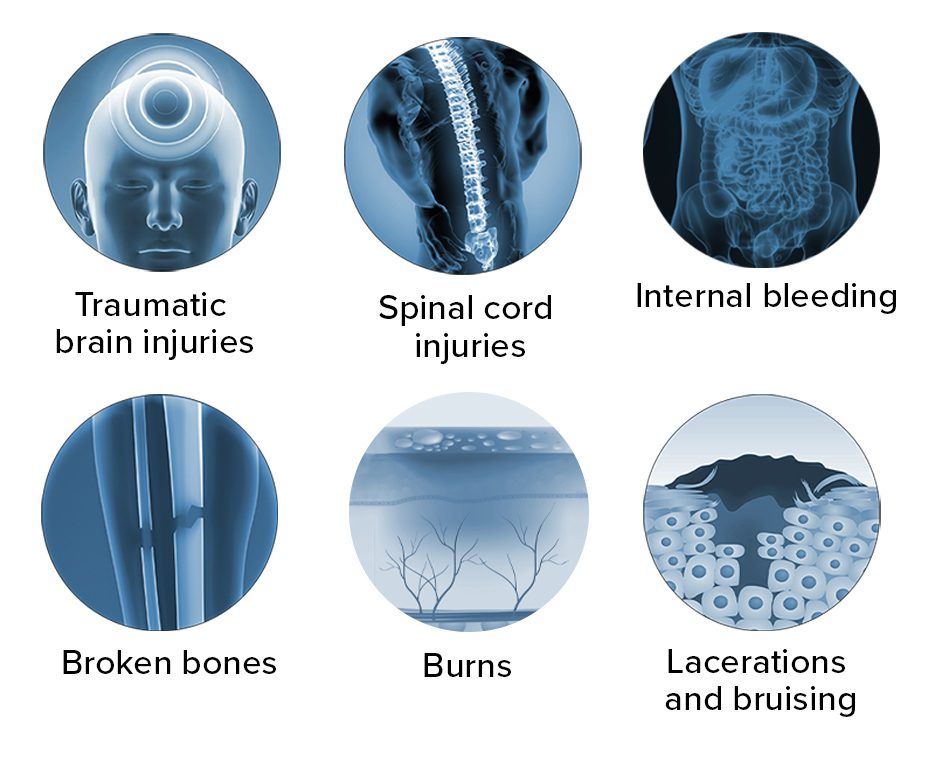 Common injuries in Bicycle Accidents