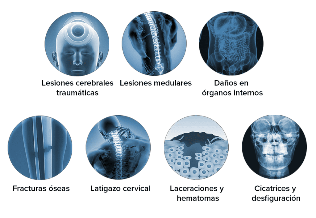 Common Injuries