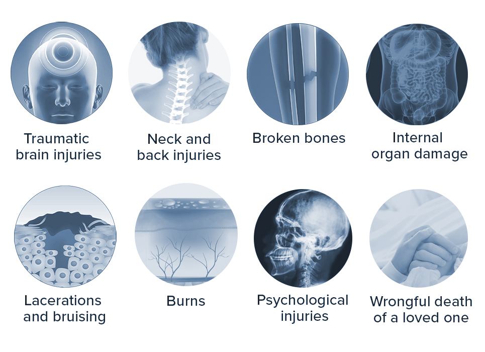 Common injuries from accidents involving trucks