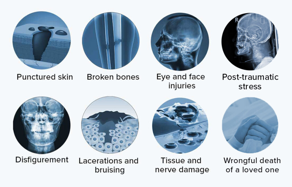 Common dog bite injuires