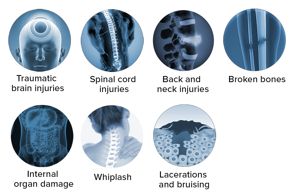 common car accident injuries