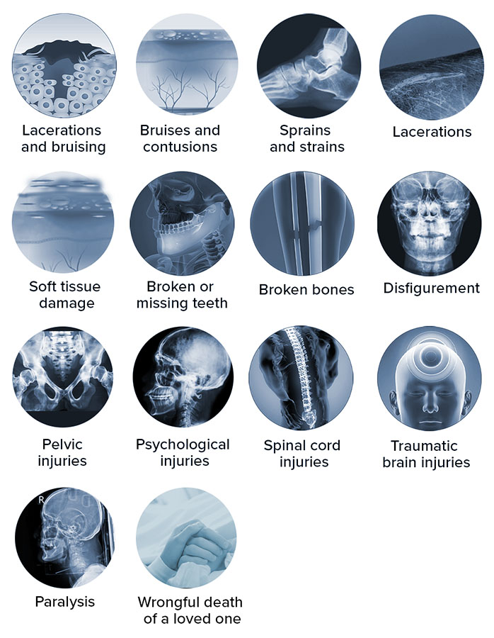 Common injuries caused by cars hitting pedestrians