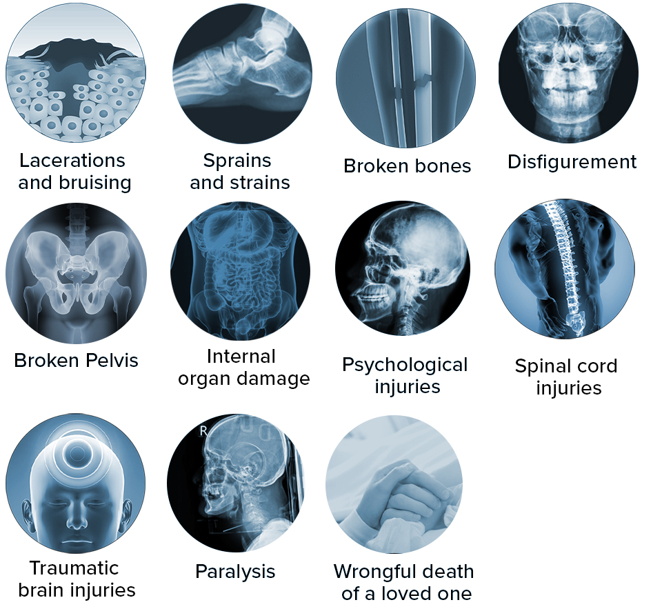 Common injuries from pedestrian accidents