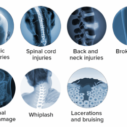 Oklahoma Car Accident Lawyers