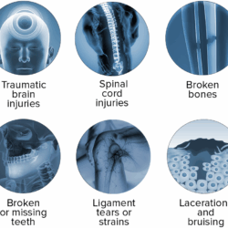 Oklahoma bicycle accident lawyers
